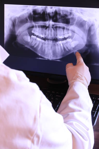 Best Urgent Tooth Repair  in Cascade, ID