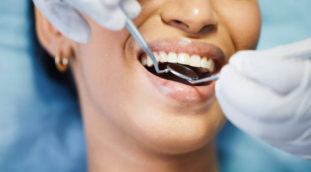 Best Broken Tooth Emergency  in Cascade, ID
