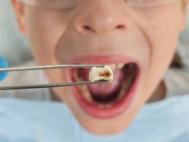 Best Emergency Gum Pain Relief  in Cascade, ID